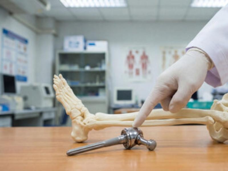 Caso real: Paciente conseguiu prótese na Justiça.