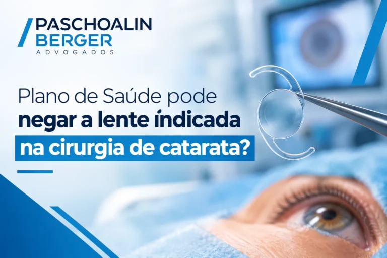 Plano de Saúde pode negar a lente indicada na cirurgia de catarata?